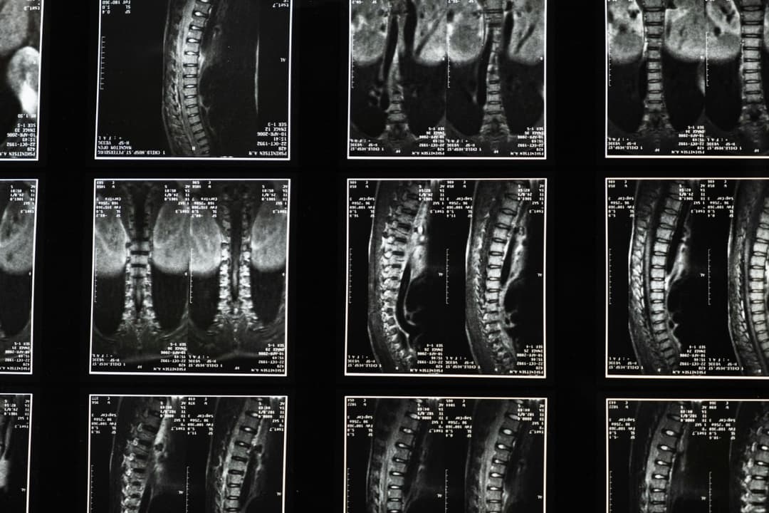 Explication de la chiropratique par Dre Nolwenn Falquet, chiropraticienne d'expérience desservant Sutton, Cowansville, Bromont et les environs